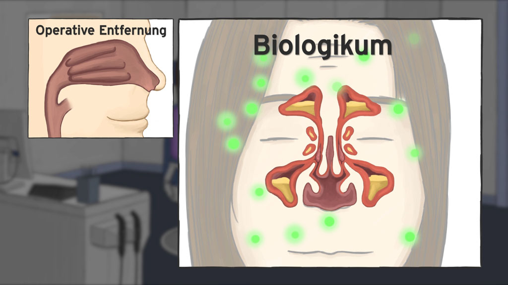 Erklärvideo